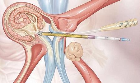 Best Spine Specialist in Patna