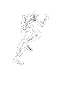 Hip Replacement Surgery
