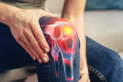 Knee Replacement 
