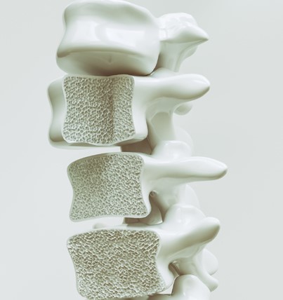 Bone tumor surgery recovery time