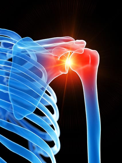 Arthroscopic Shoulder Surgery