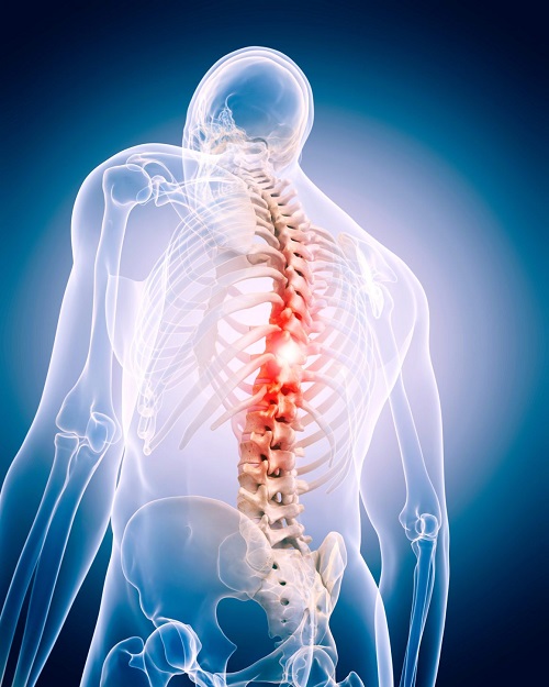Spine Surgery cost in Patna